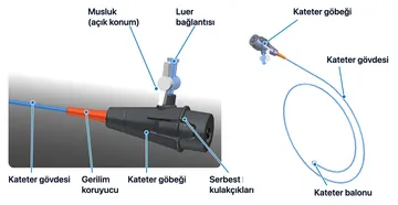 InterVapor Kateteri