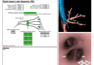 RB1 segmenti için IP3 planı: hacim, kütle, amfizem skoru ve tedavi süresi